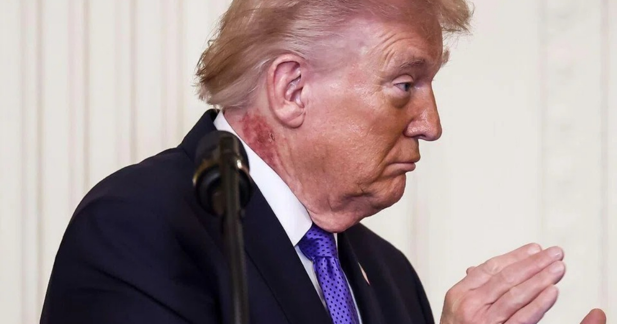 White House Says Trump Using Preventative Skin Treatment For Neck Rash